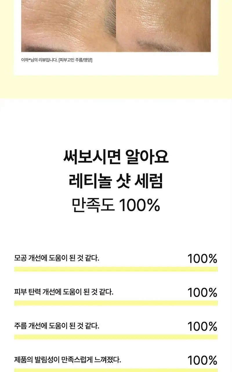 [모공/탄력/결] 셀리맥스 더 비타 A 레티놀 샷 타이트닝 세럼 30ml 상세페이지 14